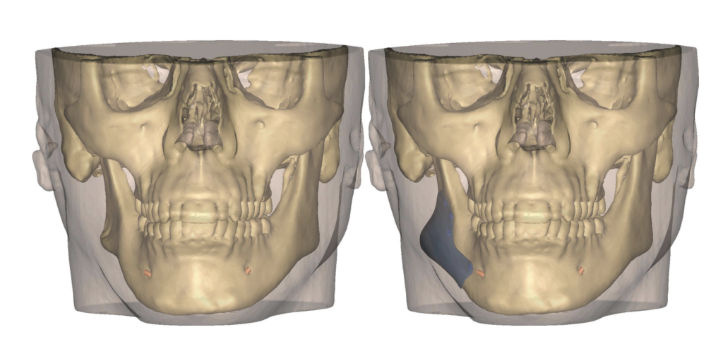 Anatomie planifiée vue de face