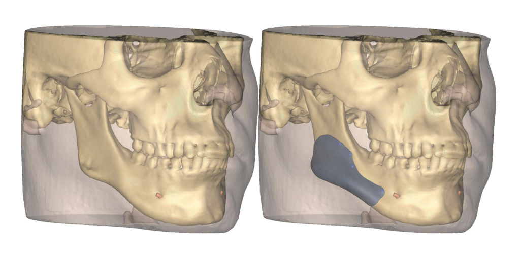 Anatomie planifiée vue de profil